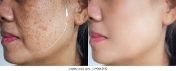 Youthful Skin