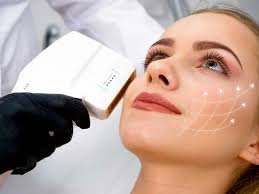 HIFU Treatment