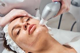 PhotoFacial Treatment
