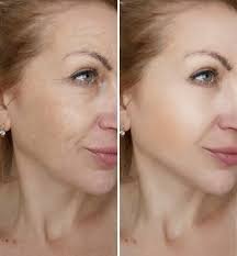 Collagen Boosted Skin