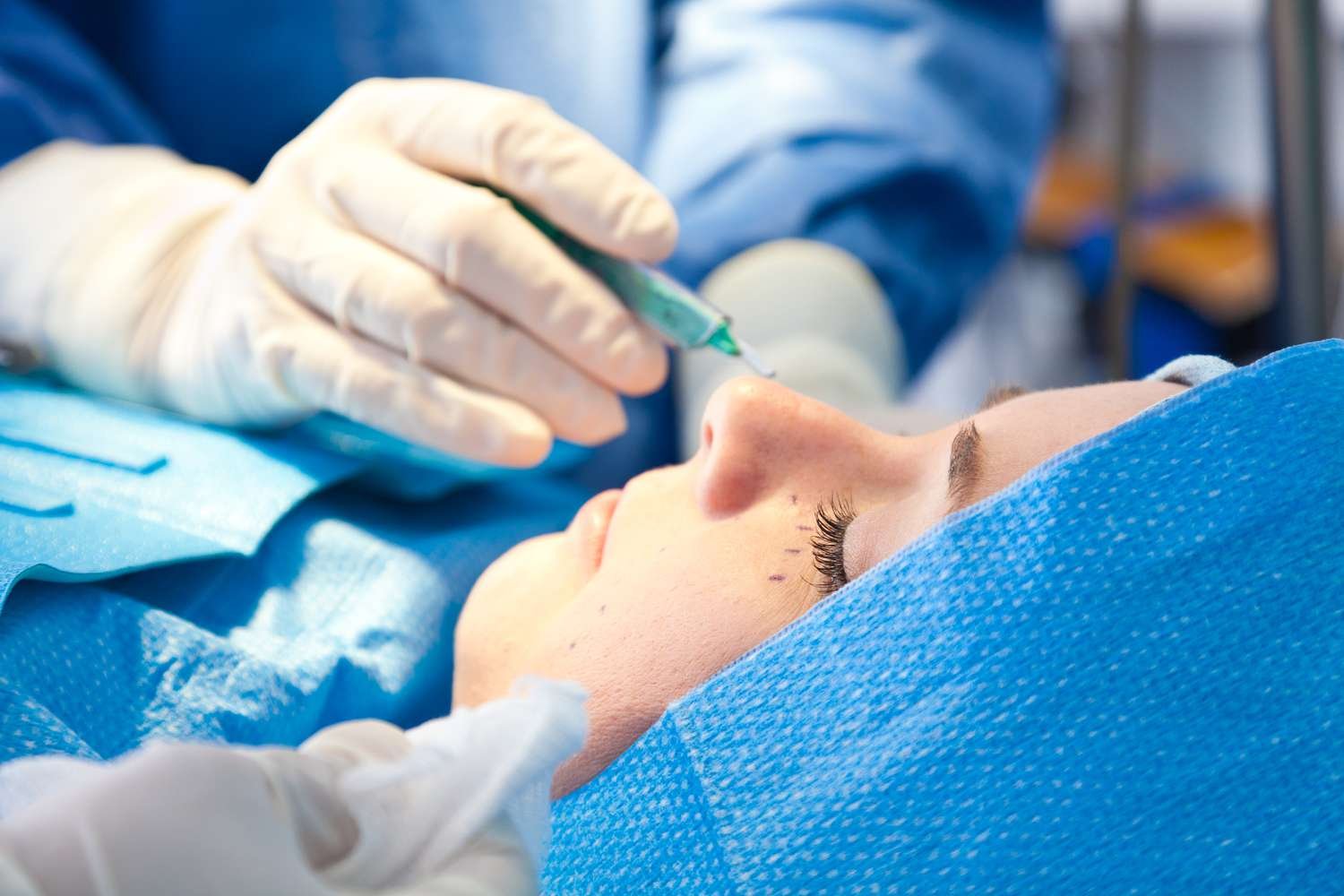 Alopecia Treatment